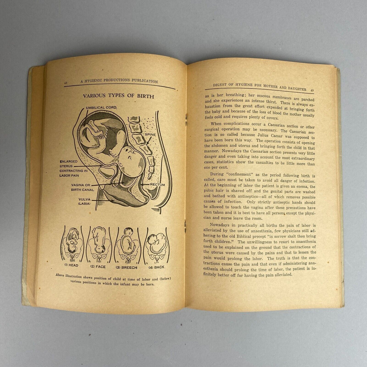 1947 Digest of Hygiene, Mother and Daughter - Edited by M.A. Horn